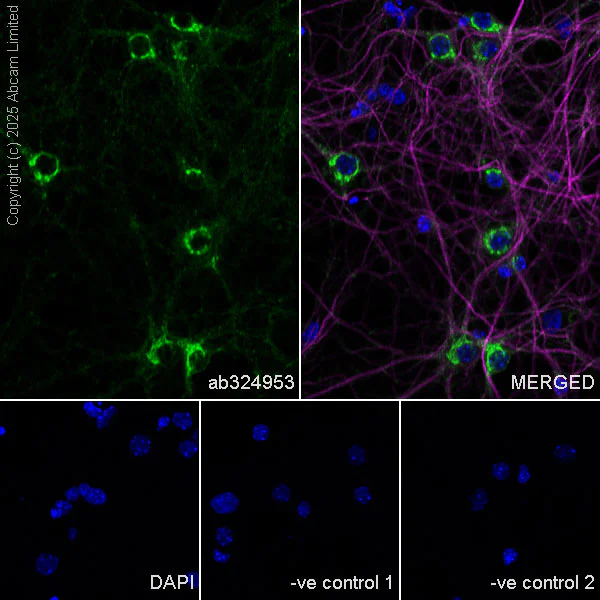 Immunocytochemistry/ Immunofluorescence - Anti-Neurobeachin antibody [EPR30440-555] (AB324953)