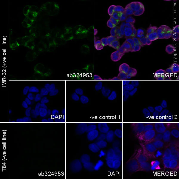 Immunocytochemistry/ Immunofluorescence - Anti-Neurobeachin antibody [EPR30440-555] (AB324953)