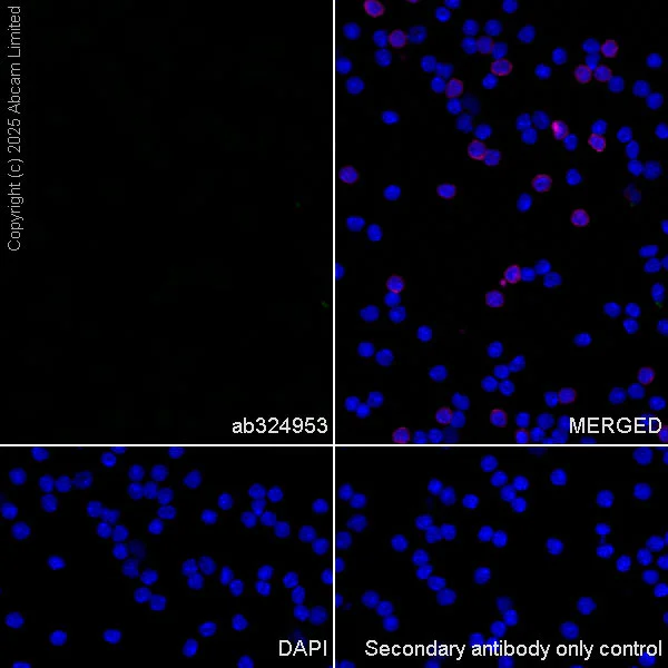 Immunocytochemistry/ Immunofluorescence - Anti-Neurobeachin antibody [EPR30440-555] (AB324953)