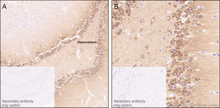 Immunohistochemistry (Formalin/PFA-fixed paraffin-embedded sections) - Anti-Neurobeachin antibody [EPR30440-555] (AB324953)