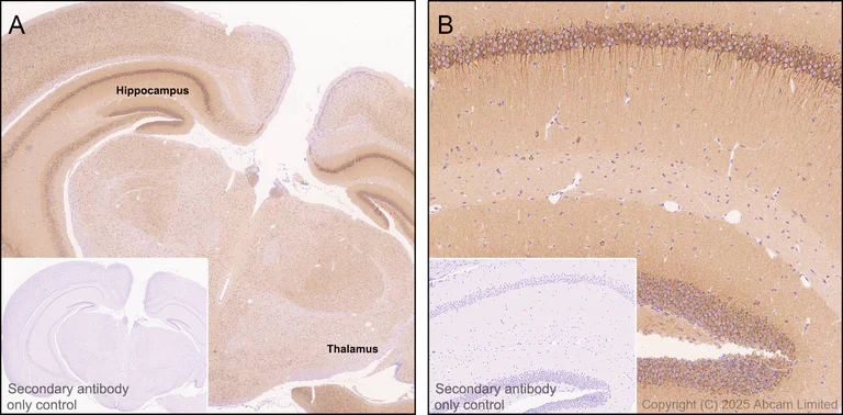 Immunohistochemistry (Formalin/PFA-fixed paraffin-embedded sections) - Anti-Neurobeachin antibody [EPR30440-555] (AB324953)