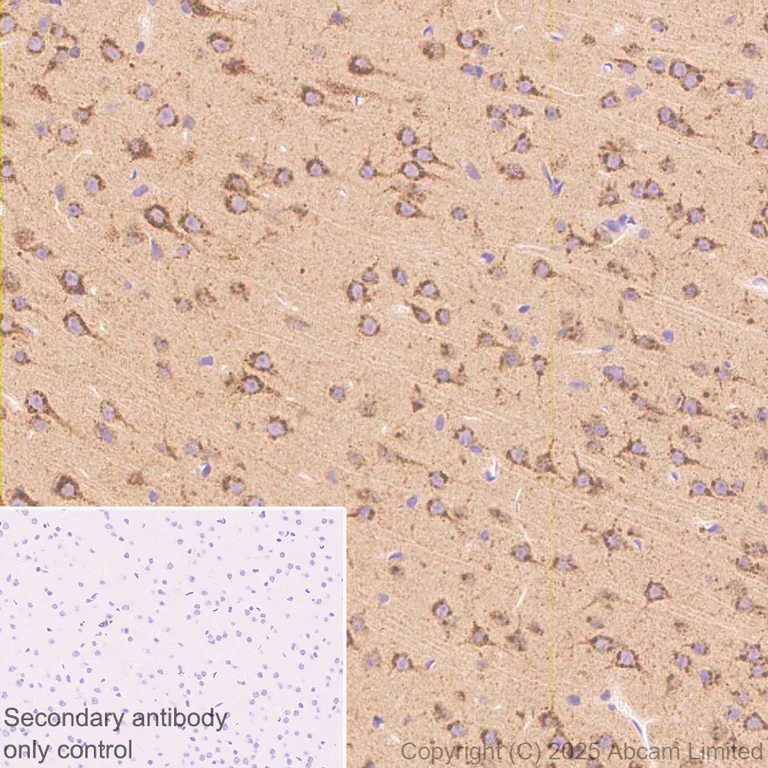 Immunohistochemistry (Formalin/PFA-fixed paraffin-embedded sections) - Anti-Neurobeachin antibody [EPR30440-555] (AB324953)