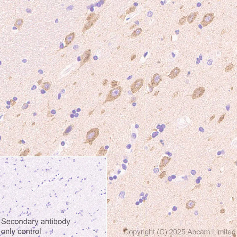 Immunohistochemistry (Formalin/PFA-fixed paraffin-embedded sections) - Anti-Neurobeachin antibody [EPR30440-555] (AB324953)