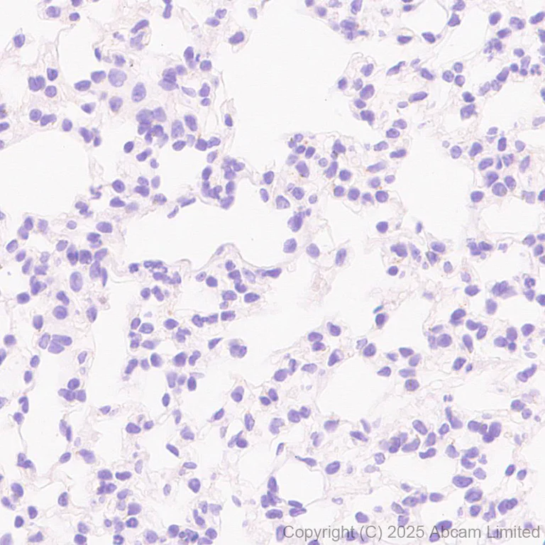 Immunohistochemistry (Formalin/PFA-fixed paraffin-embedded sections) - Anti-Neurobeachin antibody [EPR30440-555] (AB324953)