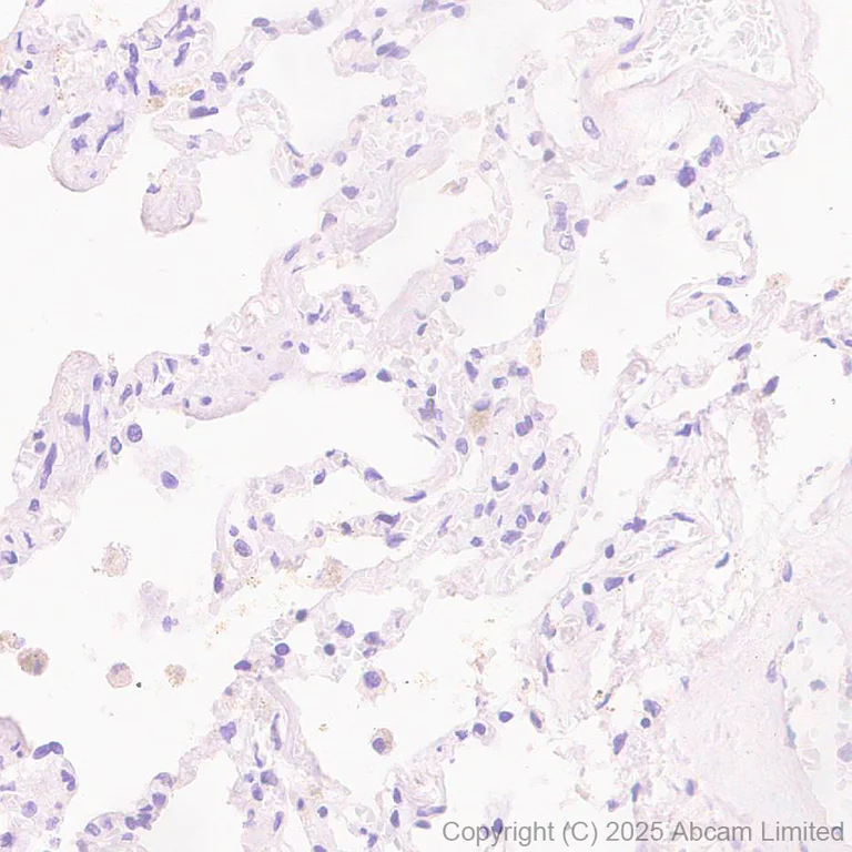 Immunohistochemistry (Formalin/PFA-fixed paraffin-embedded sections) - Anti-Neurobeachin antibody [EPR30440-555] (AB324953)