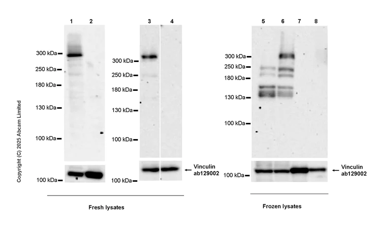 Western blot - Anti-Neurobeachin antibody [EPR30440-555] (AB324953)