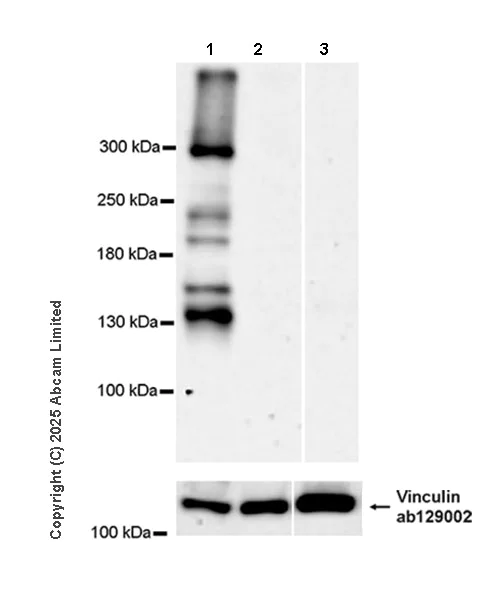 Western blot - Anti-Neurobeachin antibody [EPR30440-555] (AB324953)