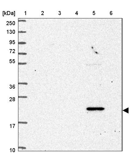 Western blot - Anti-neurobeachin-like 1 antibody (AB272650)