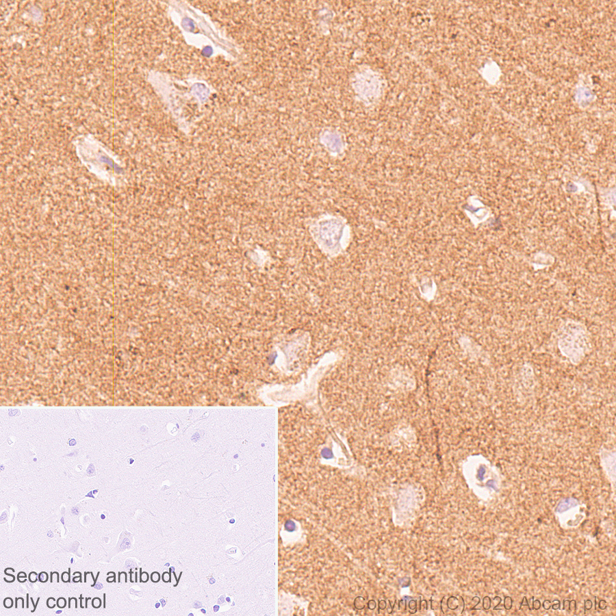 Immunohistochemistry (Formalin/PFA-fixed paraffin-embedded sections) - Anti-Neurocan antibody [EPR23425-68] (AB277525)