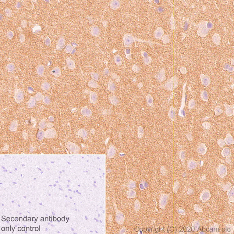 Immunohistochemistry (Formalin/PFA-fixed paraffin-embedded sections) - Anti-Neurocan antibody [EPR23425-68] - BSA and Azide free (AB277536)