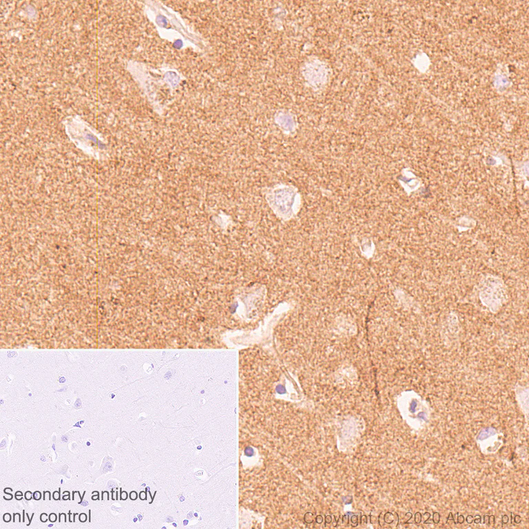 Immunohistochemistry (Formalin/PFA-fixed paraffin-embedded sections) - Anti-Neurocan antibody [EPR23425-68] - BSA and Azide free (AB277536)