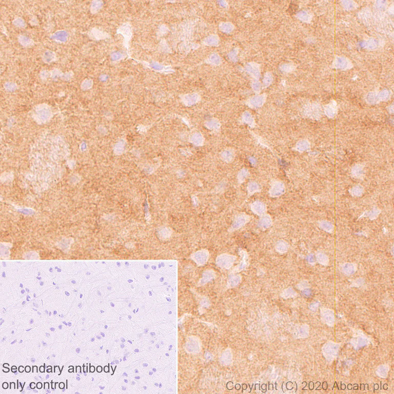 Immunohistochemistry (Formalin/PFA-fixed paraffin-embedded sections) - Anti-Neurocan antibody [EPR23425-68] - BSA and Azide free (AB277536)