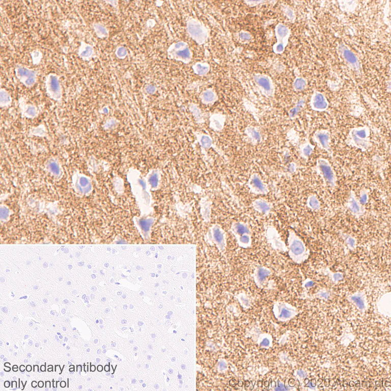 Immunohistochemistry (Formalin/PFA-fixed paraffin-embedded sections) - Anti-Neurocan antibody [EPR24126-39] - BSA and Azide free (AB279651)
