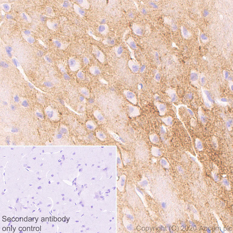 Immunohistochemistry (Formalin/PFA-fixed paraffin-embedded sections) - Anti-Neurocan antibody [EPR24126-39] - BSA and Azide free (AB279651)