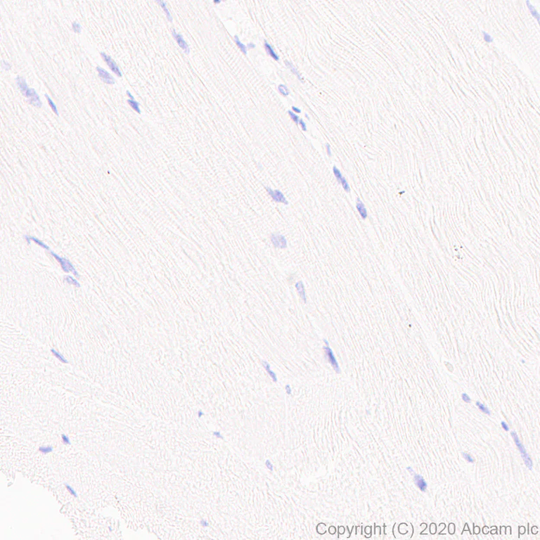 Immunohistochemistry (Formalin/PFA-fixed paraffin-embedded sections) - Anti-Neurocan antibody [EPR24126-39] - BSA and Azide free (AB279651)