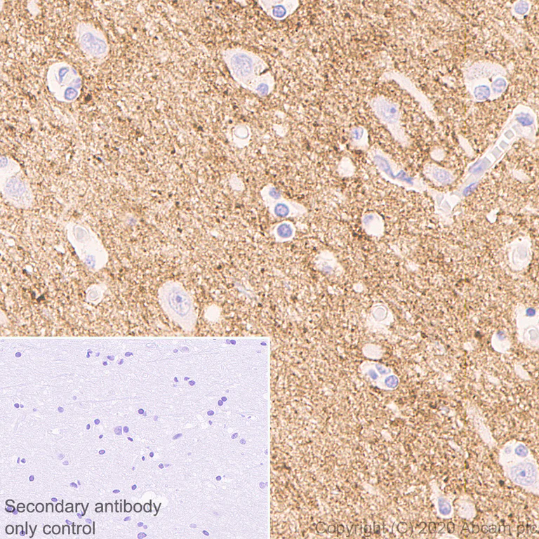 Immunohistochemistry (Formalin/PFA-fixed paraffin-embedded sections) - Anti-Neurocan antibody [EPR24126-39] - BSA and Azide free (AB279651)