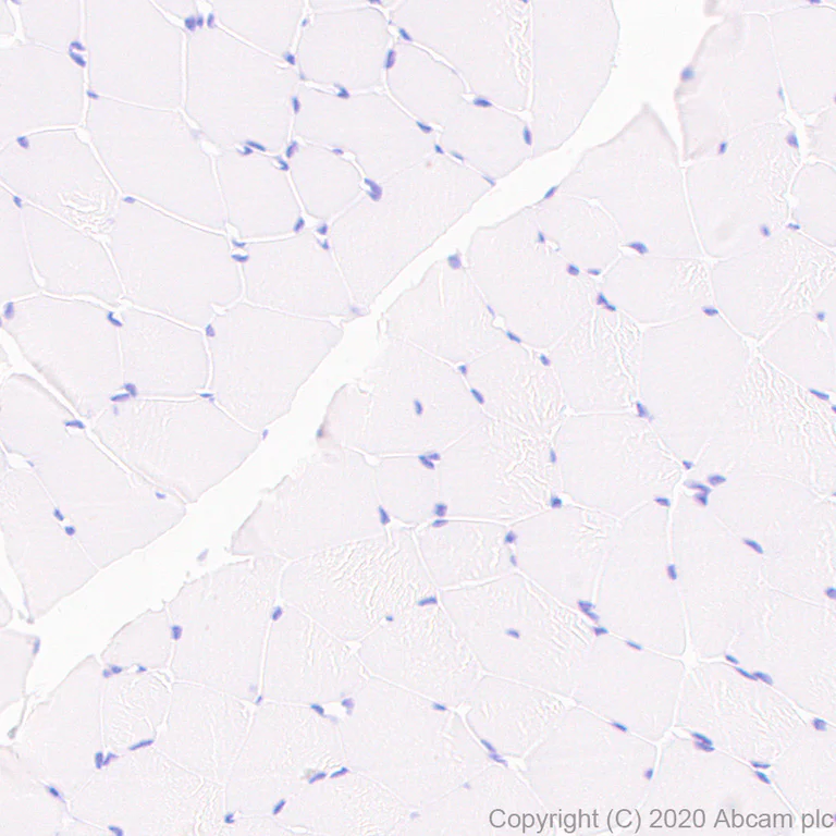 Immunohistochemistry (Formalin/PFA-fixed paraffin-embedded sections) - Anti-Neurocan antibody [EPR24126-39] - BSA and Azide free (AB279651)