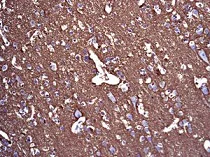 Immunohistochemistry (Formalin/PFA-fixed paraffin-embedded sections) - Anti-Neurocan antibody [EPR6397] - BSA and Azide free (AB248101)