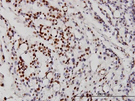 Immunohistochemistry (Formalin/PFA-fixed paraffin-embedded sections) - Anti-NeuroD1 antibody [3H8] - BSA and Azide free (AB60704)