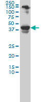 Western blot - Anti-NeuroD1 antibody [3H8] - BSA and Azide free (AB60704), expandable thumbnail