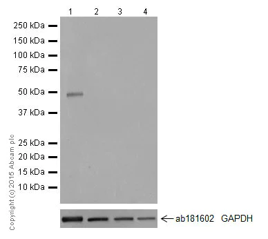 Western blot - Anti-NeuroD1 antibody [EPR17084] (AB205300)