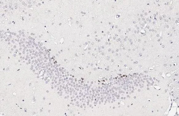 Immunohistochemistry (Formalin/PFA-fixed paraffin-embedded sections) - Anti-NeuroD1 antibody [HL3356] - BSA and Azide free (AB327519)