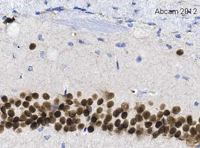 Immunohistochemistry (Formalin/PFA-fixed paraffin-embedded sections) - Anti-NeuroD2 antibody (AB104430)
