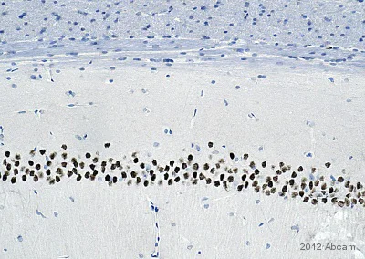 Immunohistochemistry (Formalin/PFA-fixed paraffin-embedded sections) - Anti-NeuroD2 antibody (AB104430)