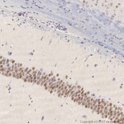 Immunohistochemistry (Formalin/PFA-fixed paraffin-embedded sections) - Anti-NeuroD2 antibody (AB104430)