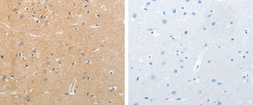 Immunohistochemistry (Formalin/PFA-fixed paraffin-embedded sections) - Anti-Neurofascin antibody (AB183082)