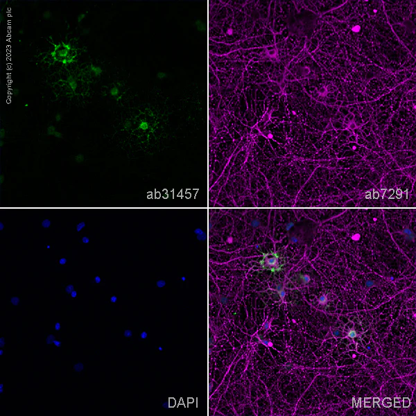Immunocytochemistry/ Immunofluorescence - Anti-Neurofascin antibody (AB31457)