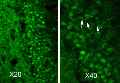 Immunohistochemistry (PFA perfusion fixed frozen sections) - Anti-Neurofascin antibody (AB31457), expandable thumbnail