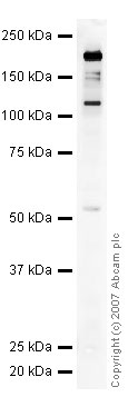 Western blot - Anti-Neurofascin antibody (AB31457), expandable thumbnail