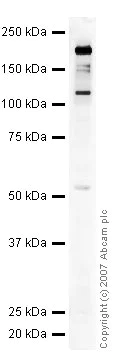Western blot - Anti-Neurofascin antibody (AB31457)