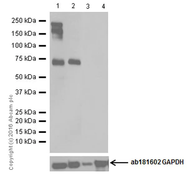 Western blot - Anti-Neurofascin antibody [EPR19003] (AB184377)