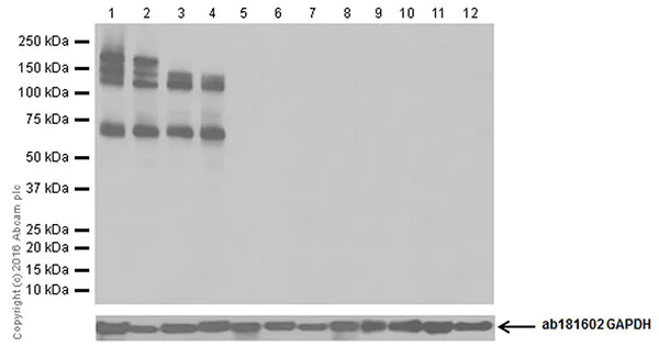 Western blot - Anti-Neurofascin antibody [EPR19003] (AB184377)