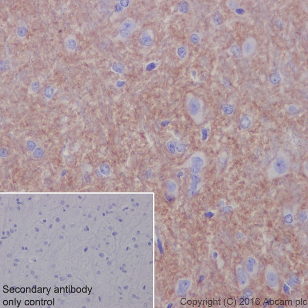 Immunohistochemistry (Formalin/PFA-fixed paraffin-embedded sections) - Anti-Neurofascin antibody [EPR19003] - BSA and Azide free (AB271948), expandable thumbnail