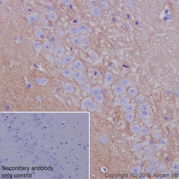 Immunohistochemistry (Formalin/PFA-fixed paraffin-embedded sections) - Anti-Neurofascin antibody [EPR19004] (AB184378)