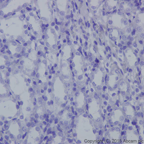 Immunohistochemistry (Formalin/PFA-fixed paraffin-embedded sections) - Anti-Neurofascin antibody [EPR19004] (AB184378)