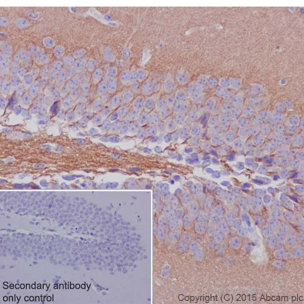 Immunohistochemistry (Formalin/PFA-fixed paraffin-embedded sections) - Anti-Neurofascin antibody [EPR19004] (AB184378)