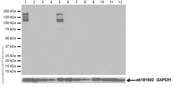 Western blot - Anti-Neurofascin antibody [EPR19004] (AB184378)
