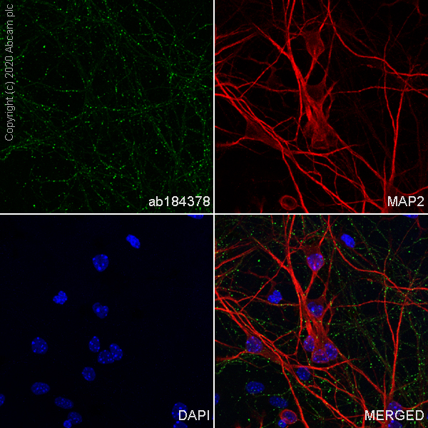Immunocytochemistry/ Immunofluorescence - Anti-Neurofascin antibody [EPR19004] - BSA and Azide free (AB250747)