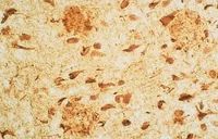 Immunohistochemistry (Formalin/PFA-fixed paraffin-embedded sections) - Anti-Neurofibrillary tangles antibody (AB136407)