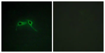 Immunocytochemistry/ Immunofluorescence - Anti-Neurofibromin antibody (AB128054)