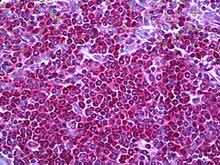 Immunohistochemistry (Formalin/PFA-fixed paraffin-embedded sections) - Anti-Neurofibromin antibody (AB128054)