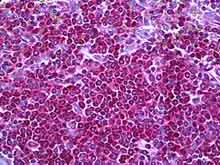 Immunohistochemistry (Formalin/PFA-fixed paraffin-embedded sections) - Anti-Neurofibromin antibody (AB128054)