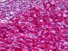 Immunohistochemistry (Formalin/PFA-fixed paraffin-embedded sections) - Anti-Neurofibromin antibody (AB128054)