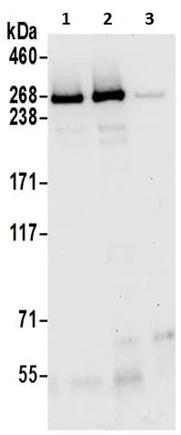 Immunoprecipitation - Anti-Neurofibromin antibody (AB17963)