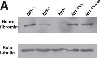 Western blot - Anti-Neurofibromin antibody (AB17963), expandable thumbnail