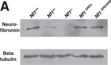 Western blot - Anti-Neurofibromin antibody (AB17963)